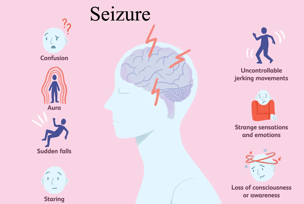 Seizures